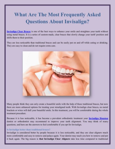 What Are The Most Frequently Asked Questions About Invisalign