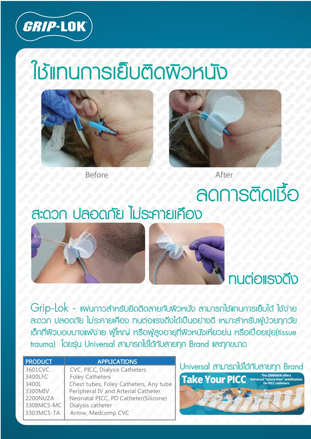 Griplok securement device catalog jirat.st Page 9 Flip PDF