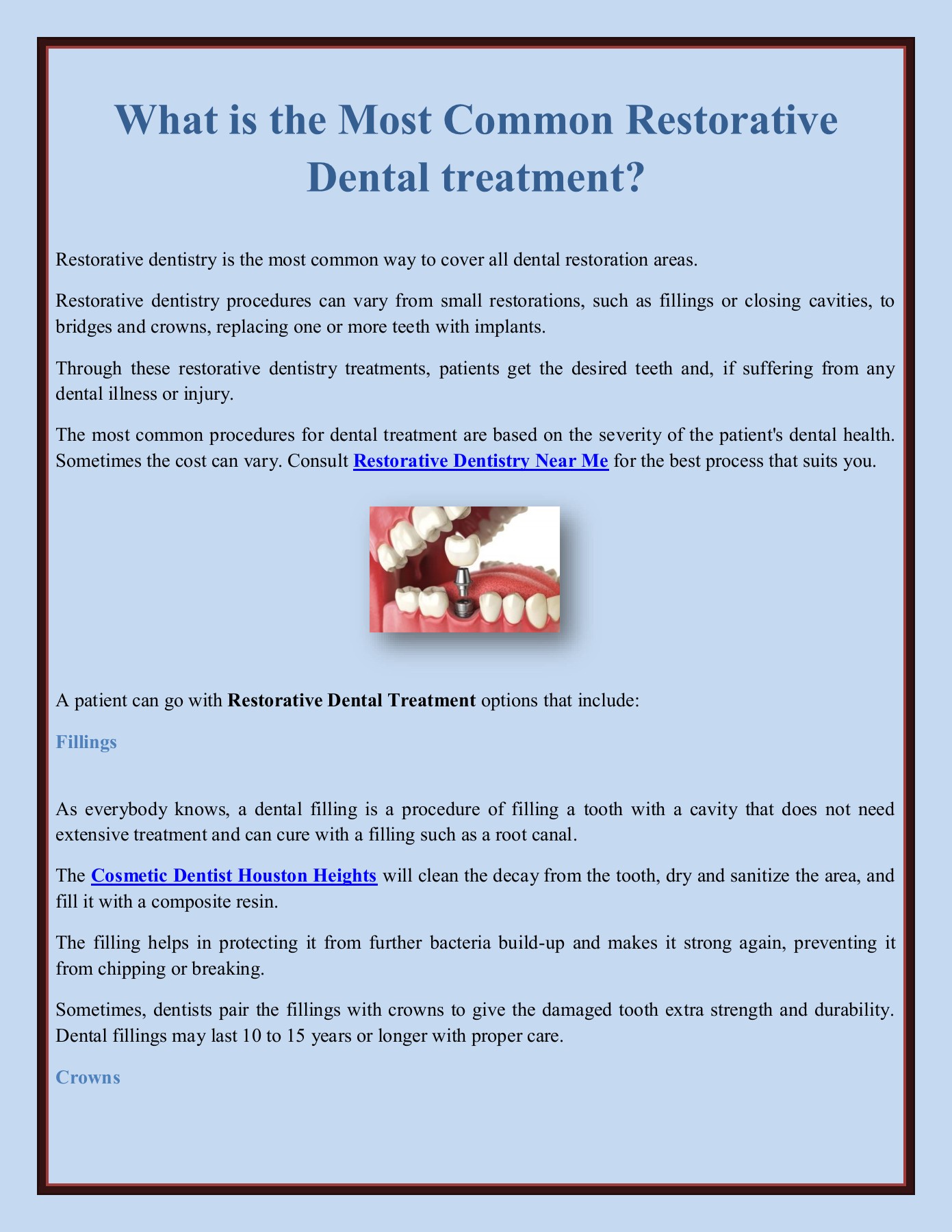 What is the Most Common Restorative Dental treatment? Richard Govan