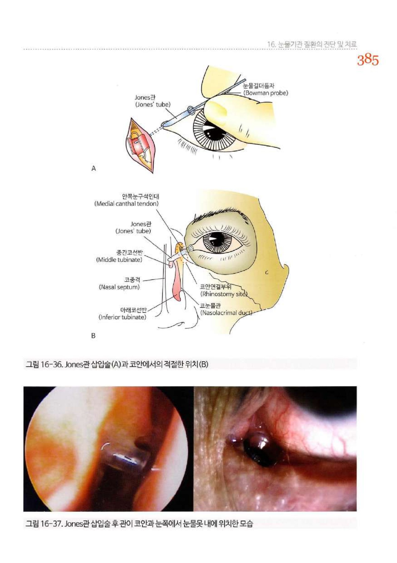 유방암 방사선 치료 명의]대림성모병원 김주리 방사선종양센터장 “초기 방사선 치료 받아야” : 네이버 블로그, image size:1268x1800