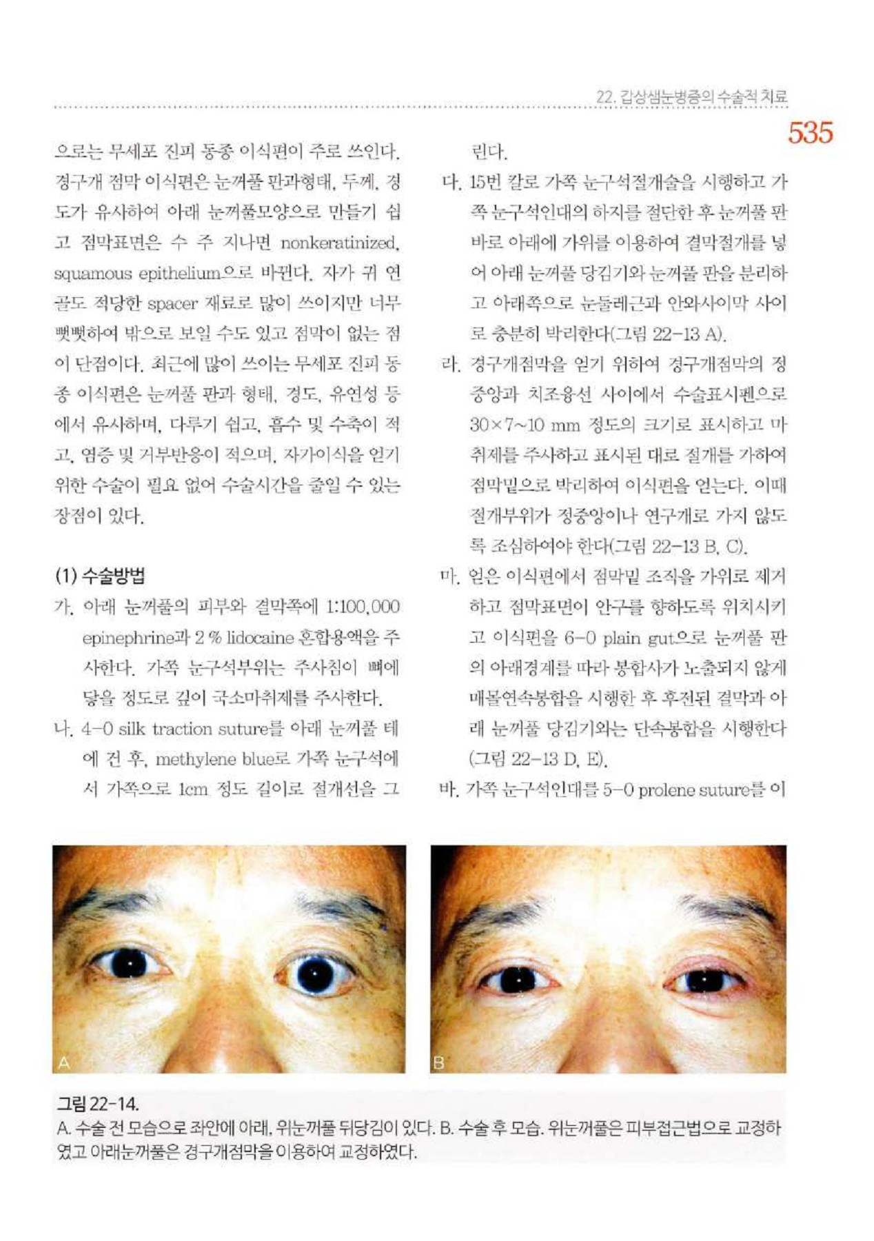 쿤룬산 눈국화 - 100g - 프리미엄 품질 | Lemeilleurthedechine, image size:1268x1800