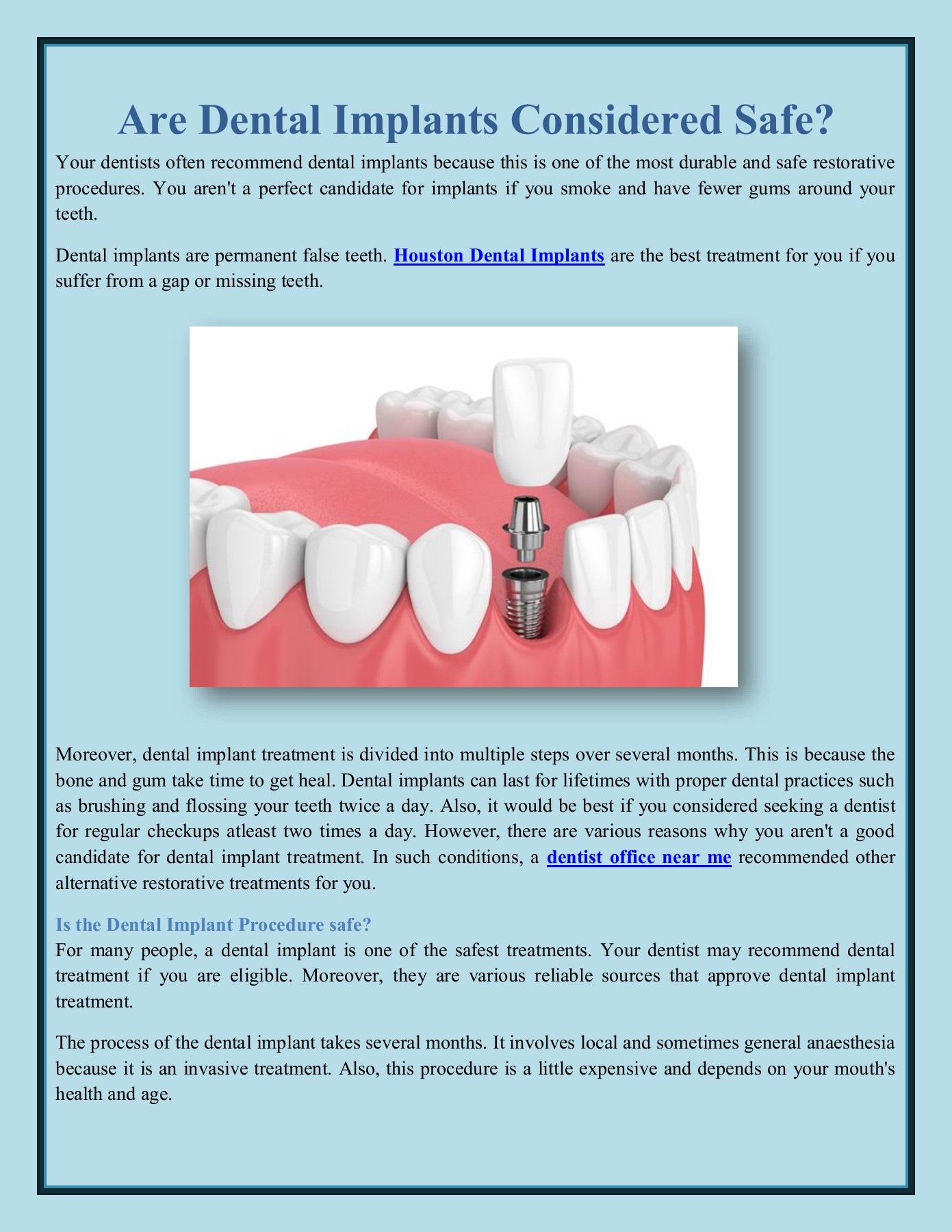 Are Dental Implants Considered Safe? Emergency Dentistinhouston