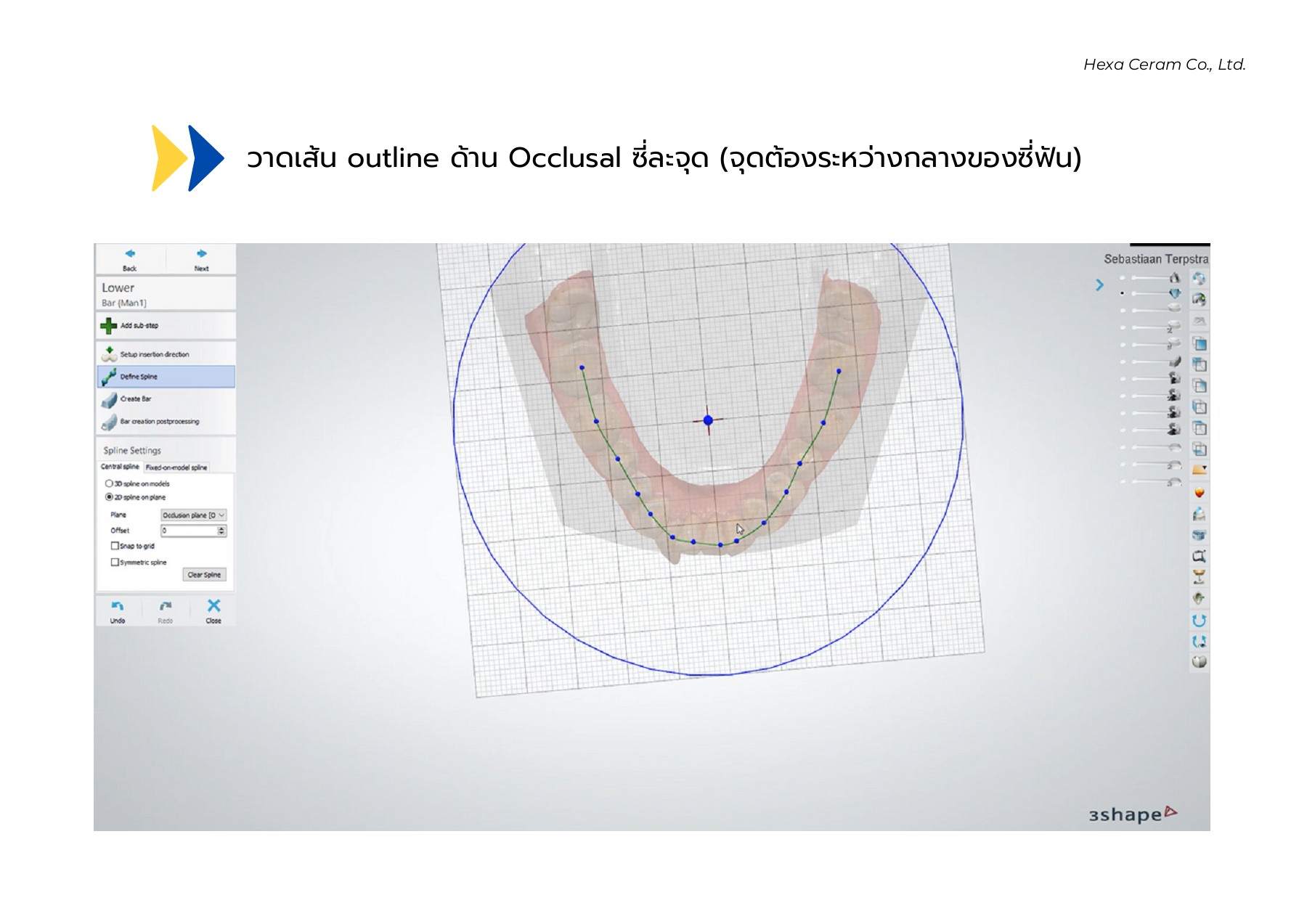 Ortho - Stop (ฟันล่าง) - Hexa Ceram Library - หน้าหนังสือ 30 | พลิก PDF ...