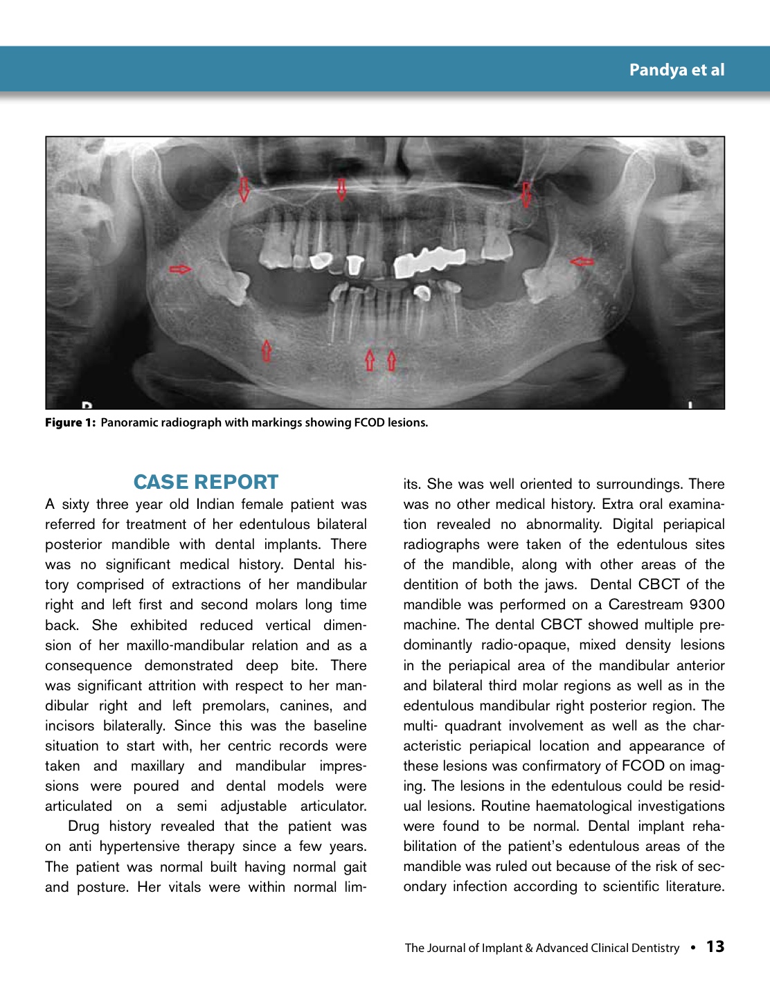 Journal of Implant and Advanced Clinical Dentistry July 2018 JIACD