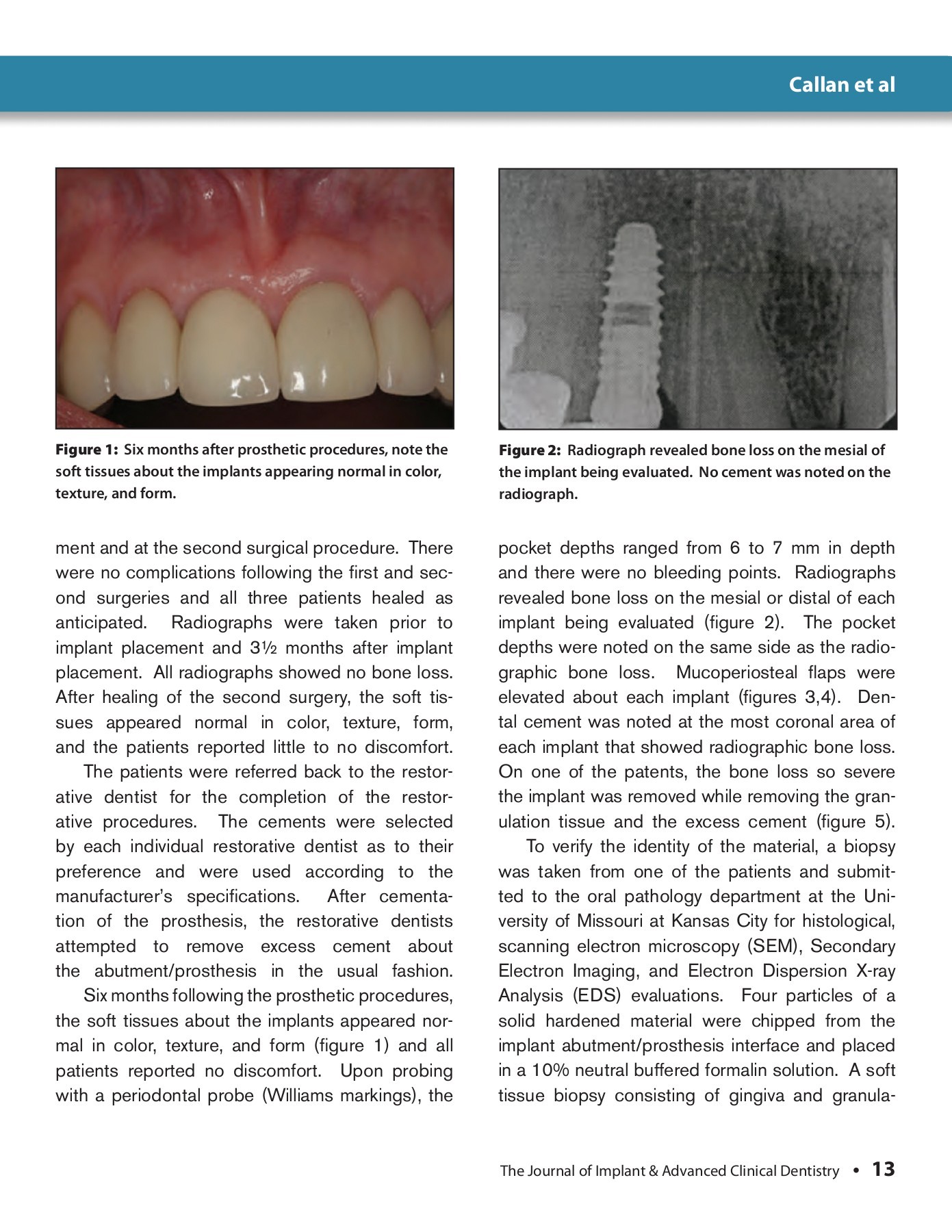Journal of Implant and Advanced Clinical Dentistry June 2013 JIACD