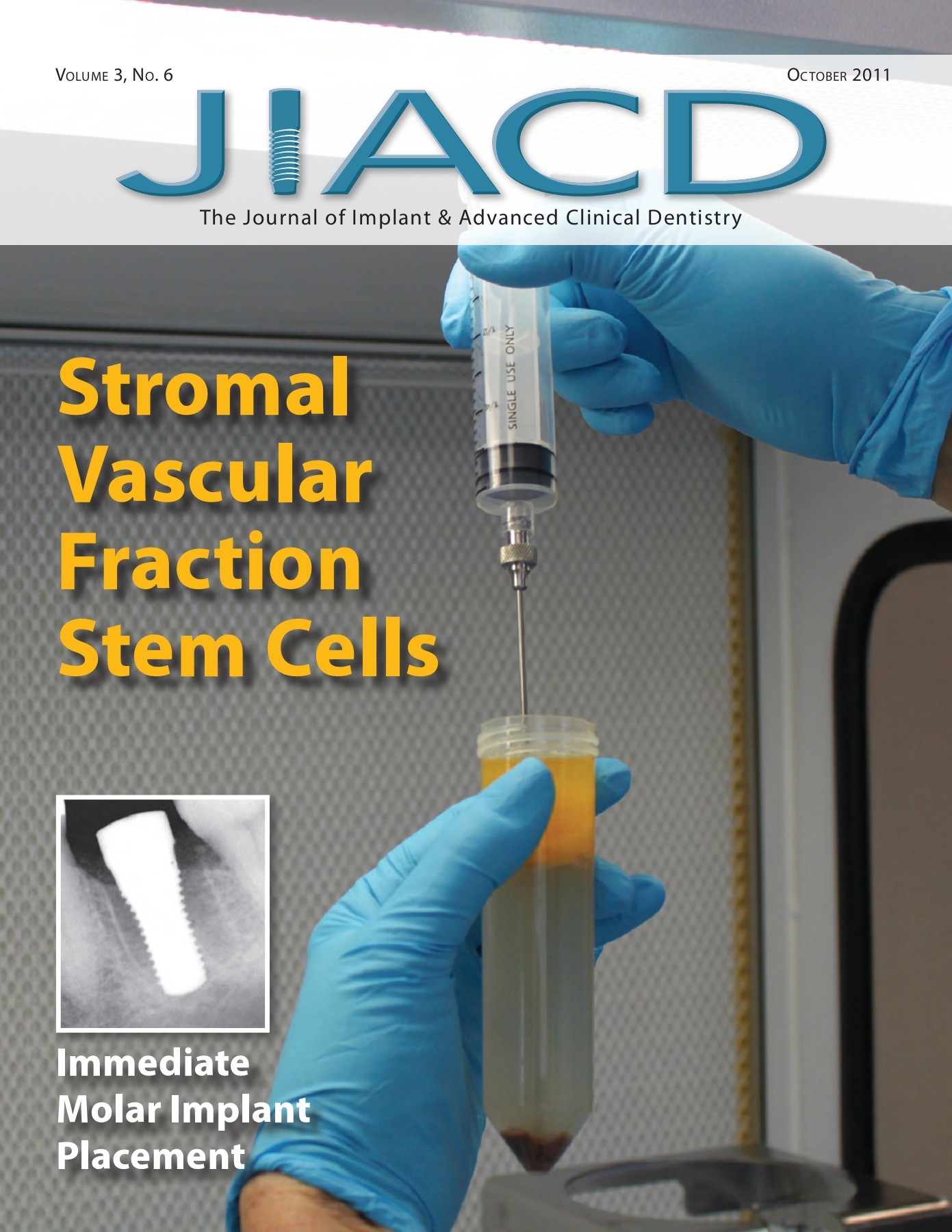 Journal of Implant and Advanced Clinical Dentistry October 2011 JIACD