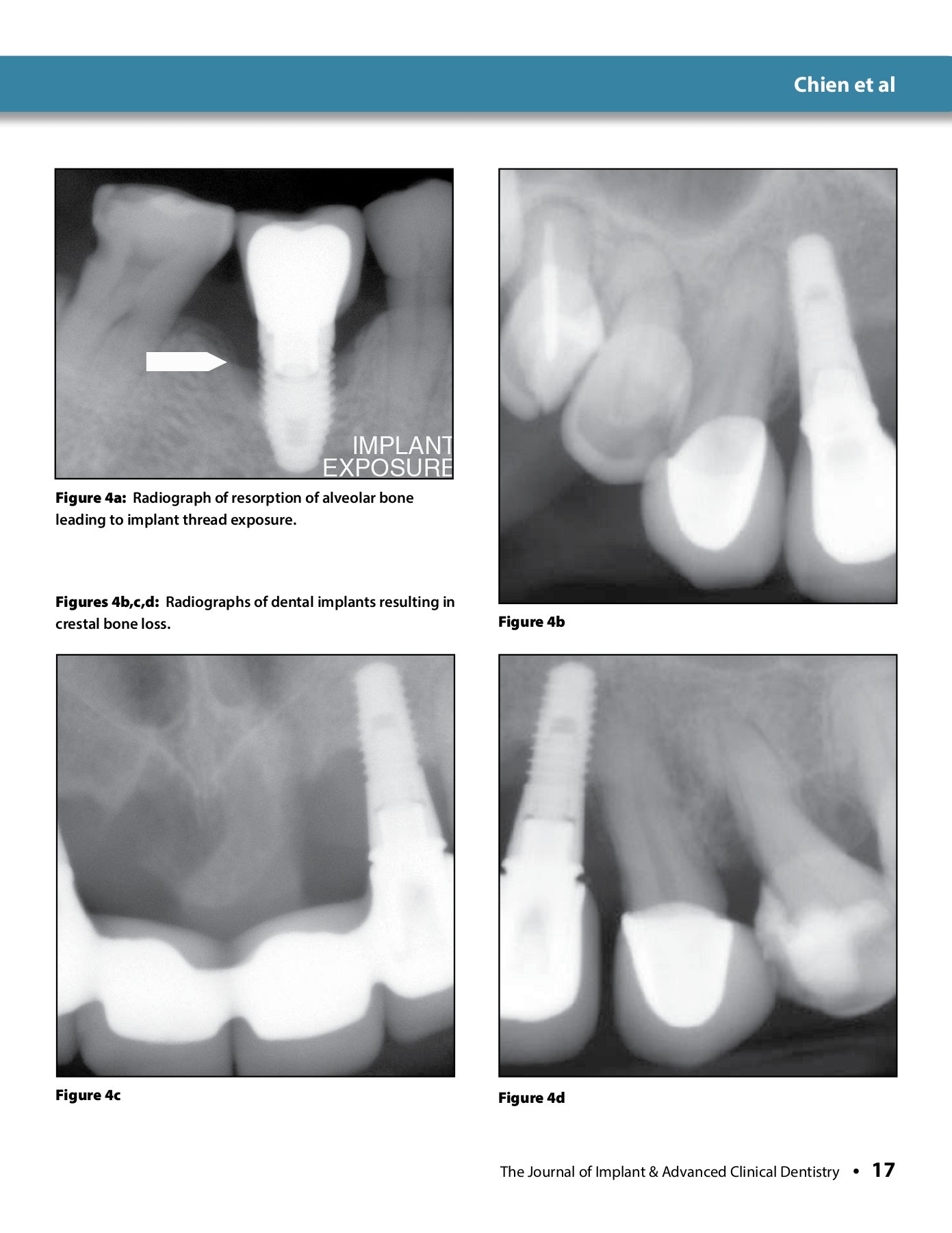 Journal of Implant and Advanced Clinical Dentistry September 2014