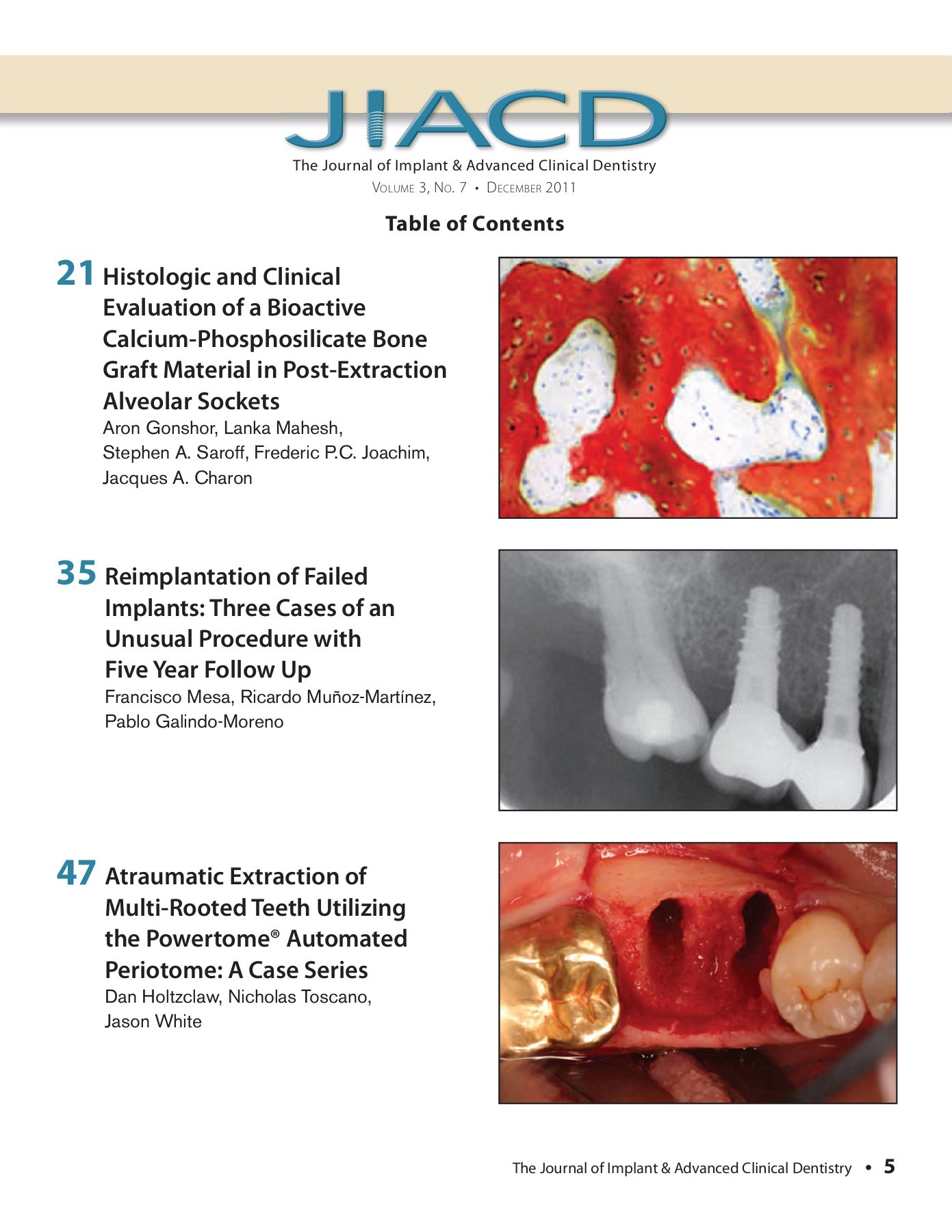 Journal of Implant and Advanced Clinical Dentistry December 2012