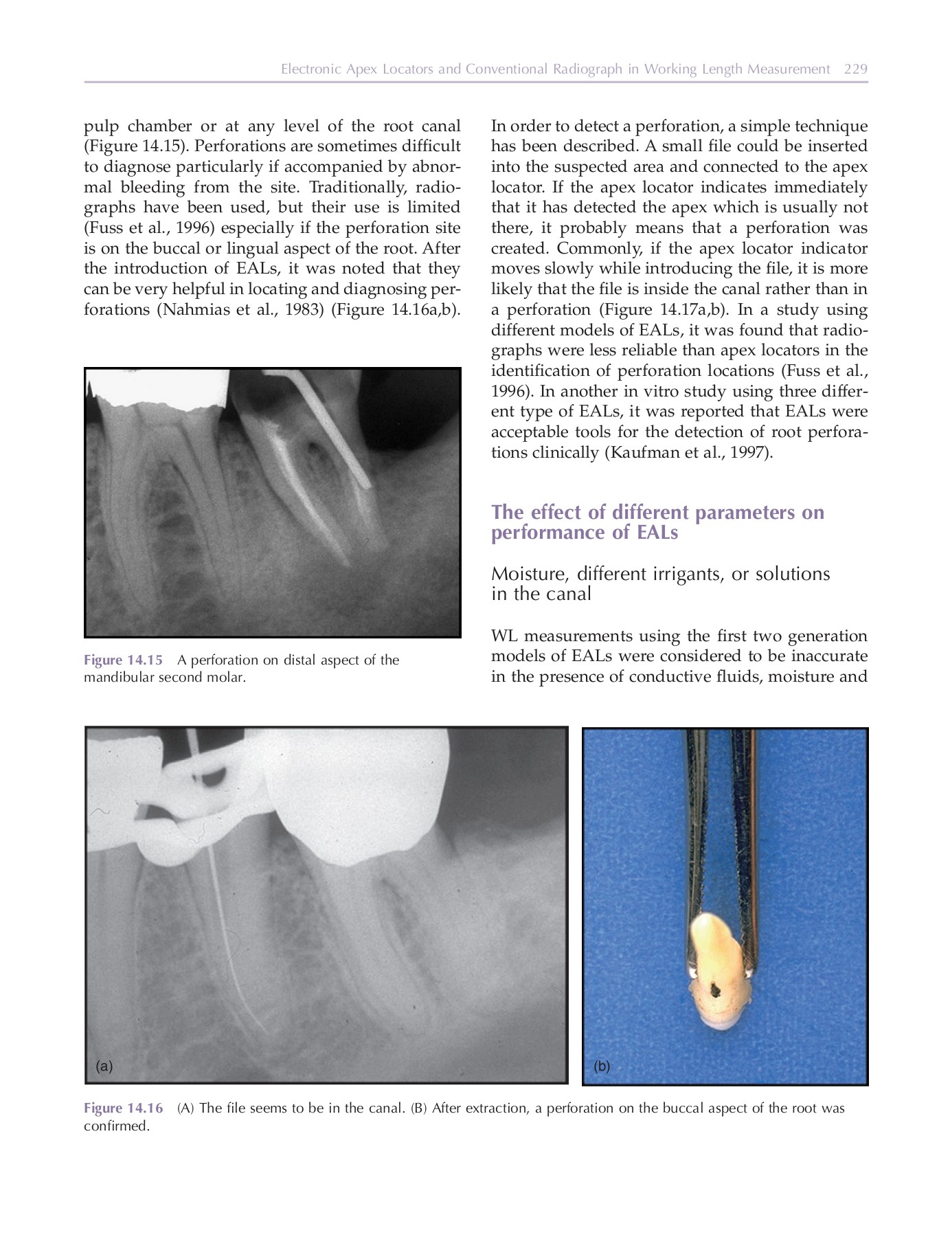 Endodontic radiology DentLib CMU Page 249 Flip PDF Online PubHTML5