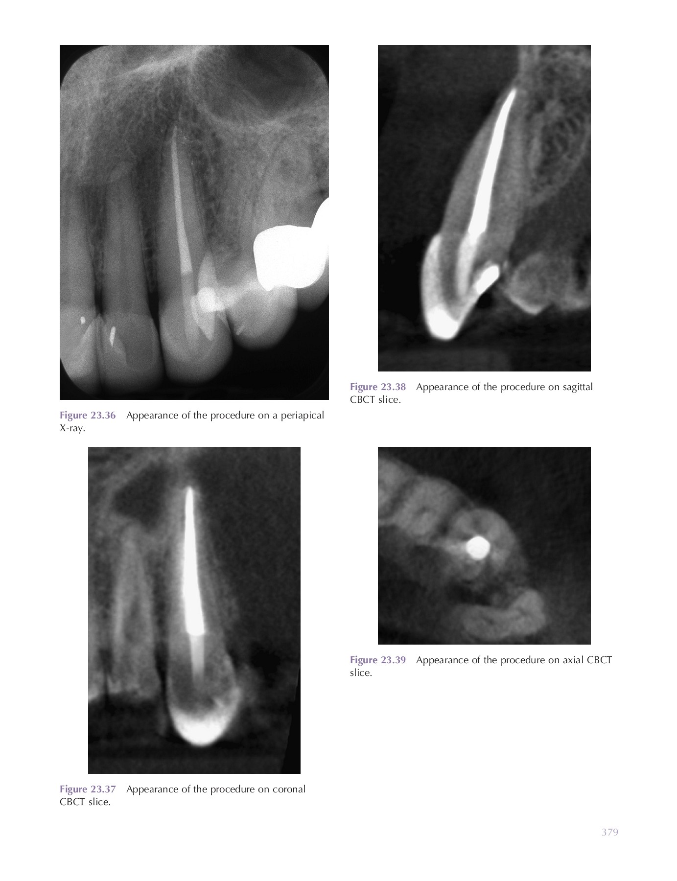 Endodontic radiology DentLib CMU Page 399 Flip PDF Online PubHTML5