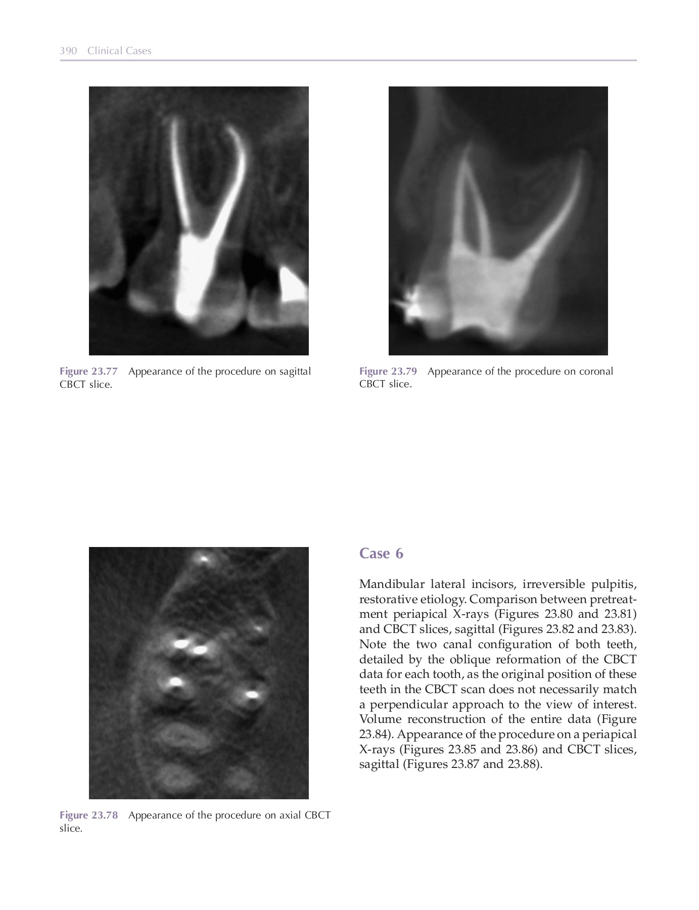 Endodontic radiology DentLib CMU Page 410 Flip PDF Online PubHTML5