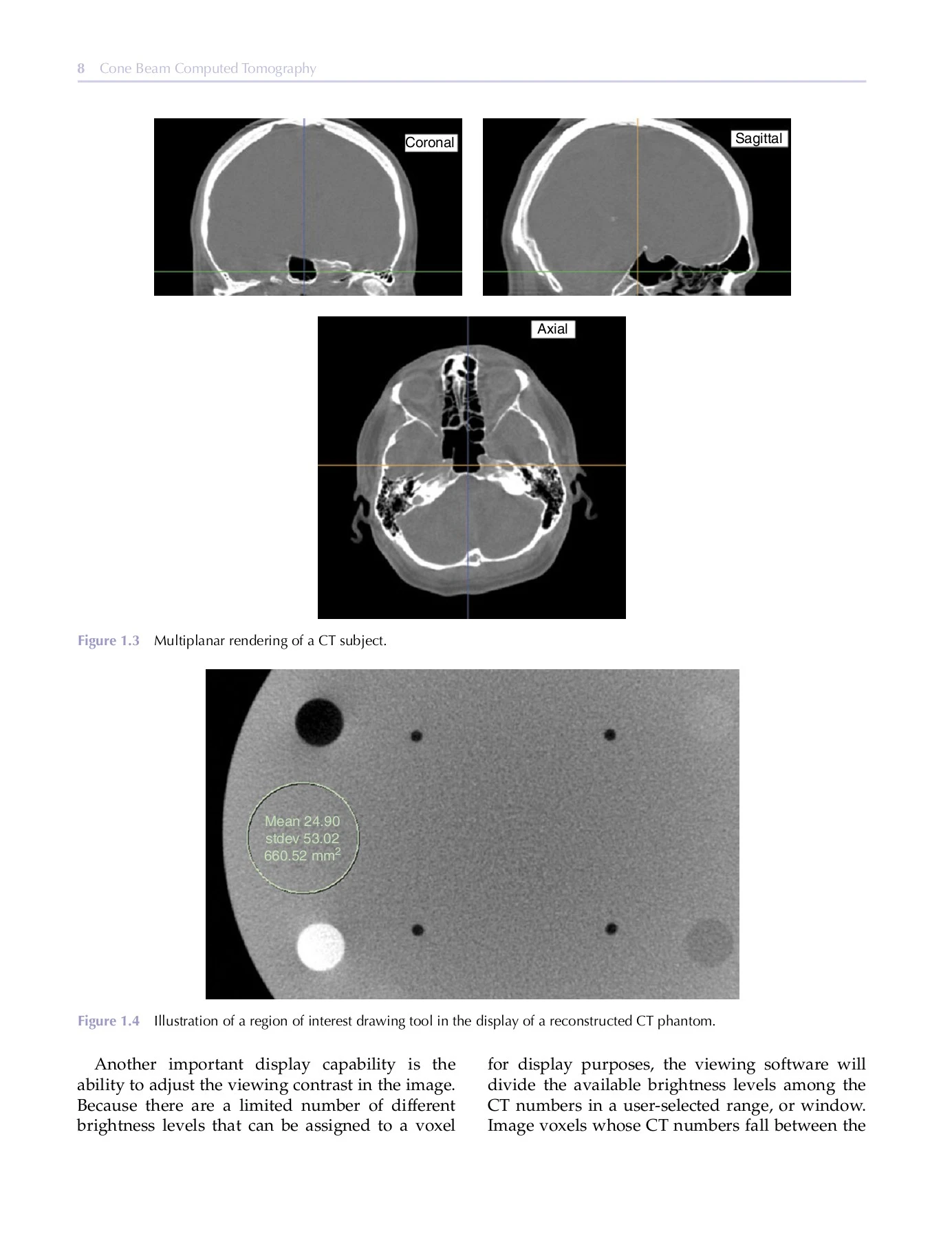 Cone Beam Computed Tomography - DentLib CMU - Page 299 | Flip PDF ...