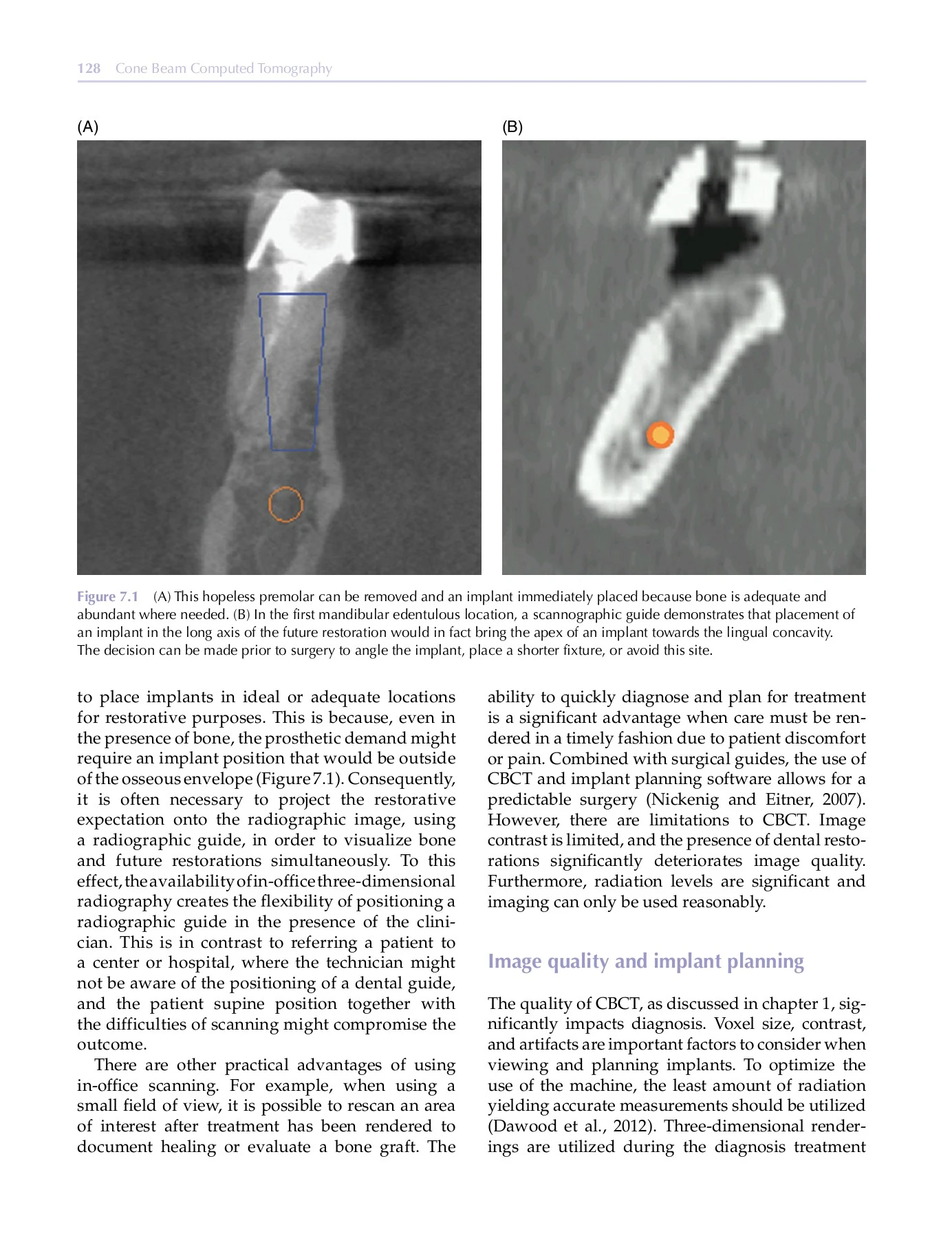 Cone Beam Computed Tomography - DentLib CMU - Page 416 | Flip PDF ...
