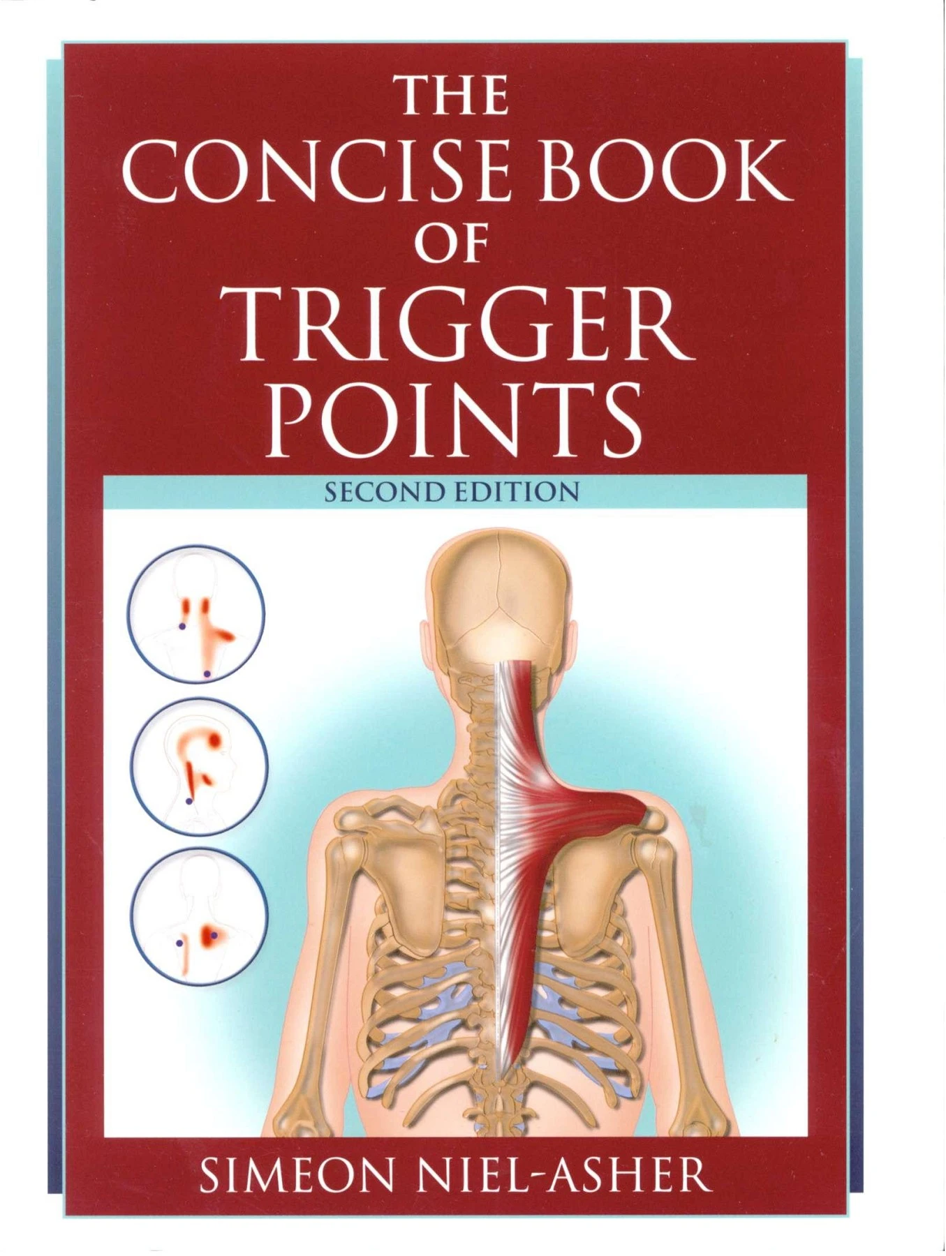 Trigger Point Book Concise Book of Trigger Points - LATE SURESHANNA BATKADLI COLLEGE OF ...